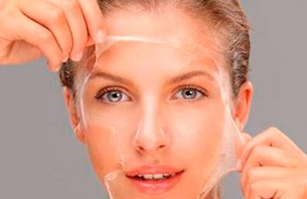 Peeling - Clínica Aguilar Rosell