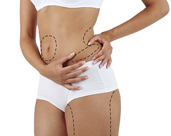 liposuccion - Clínica Aguilar Rosell Torremolinos