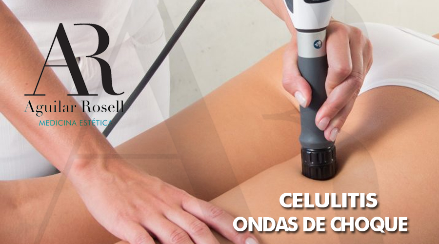 ondas de choque antes y despues