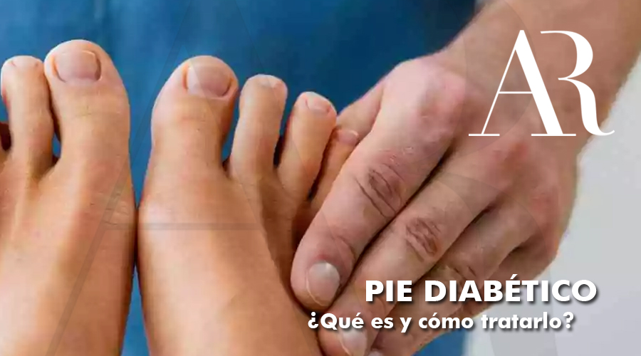 pie diabetico torremolinos