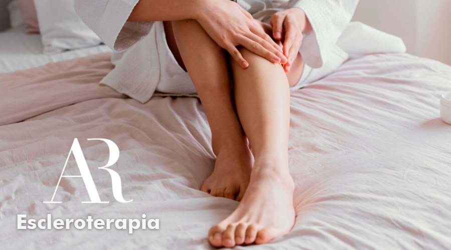 escleroterapia varices torremolinos malaga